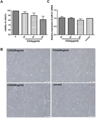 Chlorogenic Acid Inhibits Liver Fibrosis by Blocking the miR-21-Regulated TGF-β1/Smad7 Signaling Pathway in Vitro and in Vivo